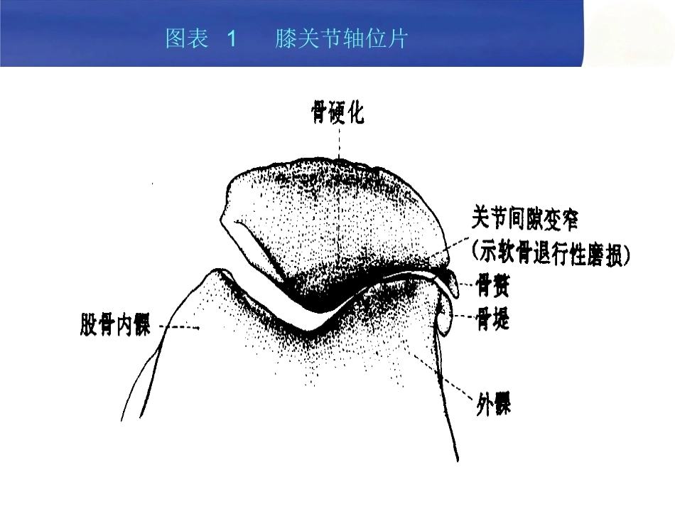膝关节骨性关节 炎的中西医治疗_第10页