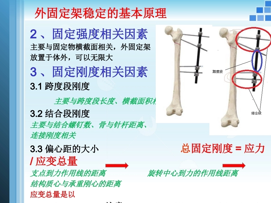 外固定支架的力学 原理_第10页