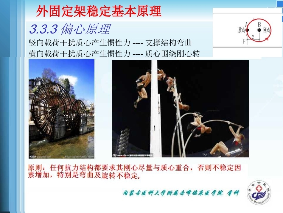 外固定支架的力学 原理_第12页