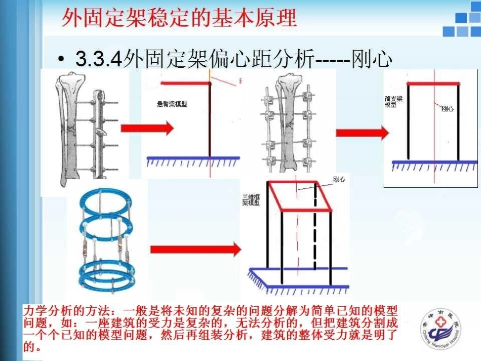 外固定支架的力学 原理_第13页