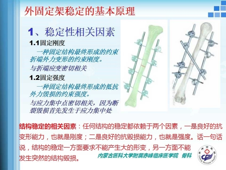 外固定支架的力学 原理_第9页