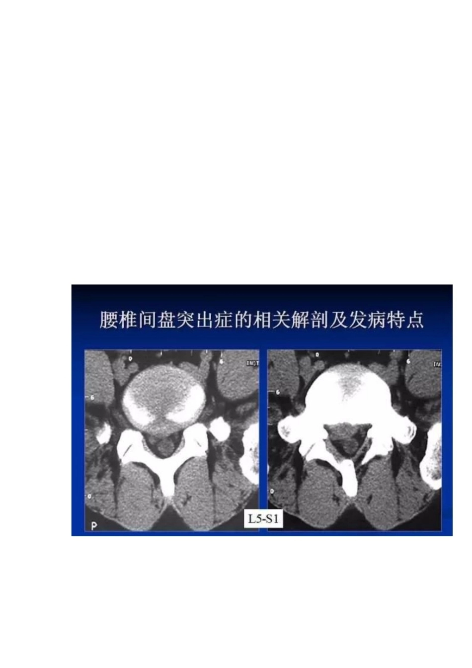 人工全膝关节置换手术 技术汇总_第11页