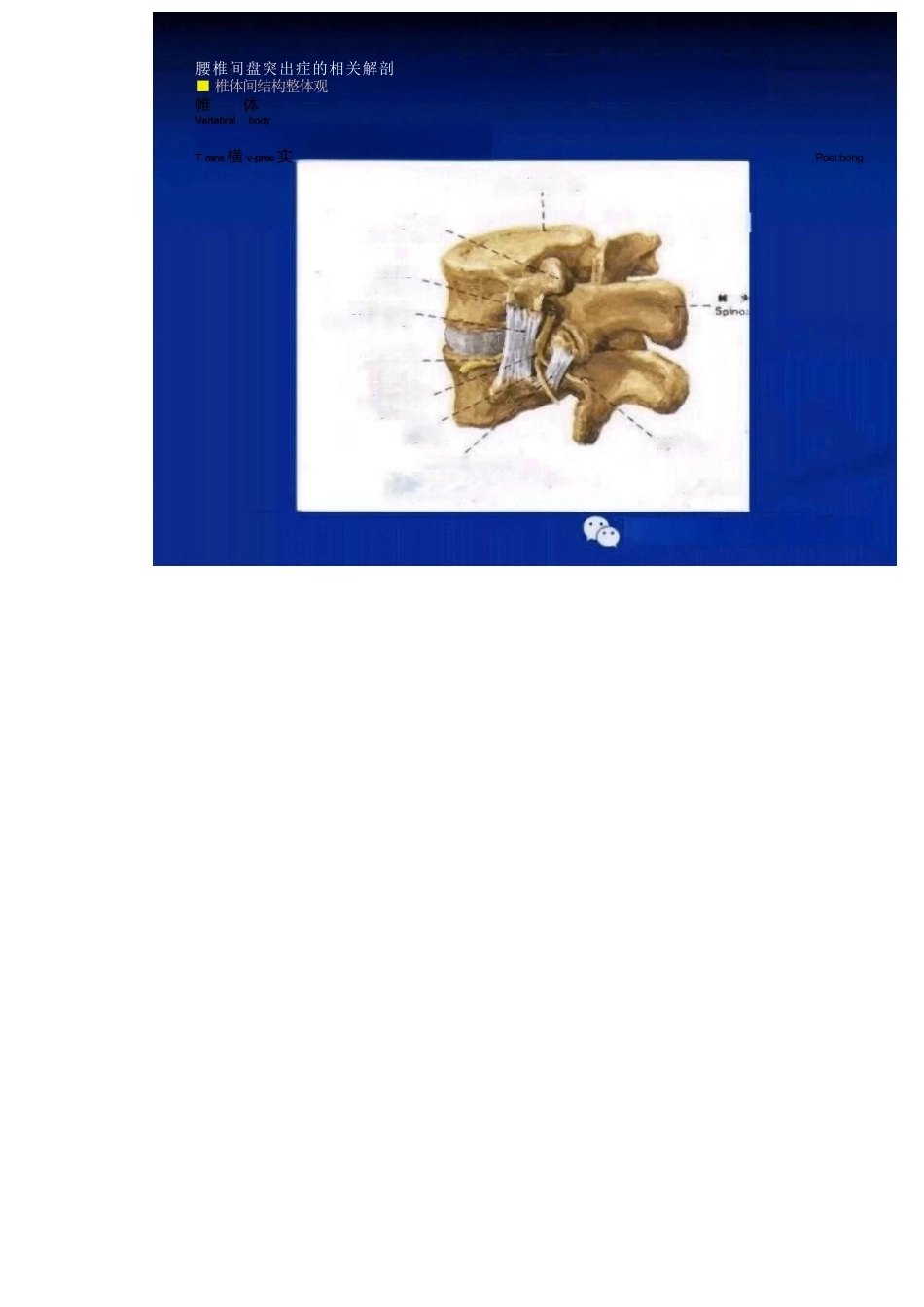 人工全膝关节置换手术 技术汇总_第2页