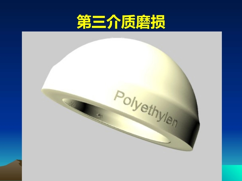 人工全髋关节翻修的思考和 处理策略_第10页
