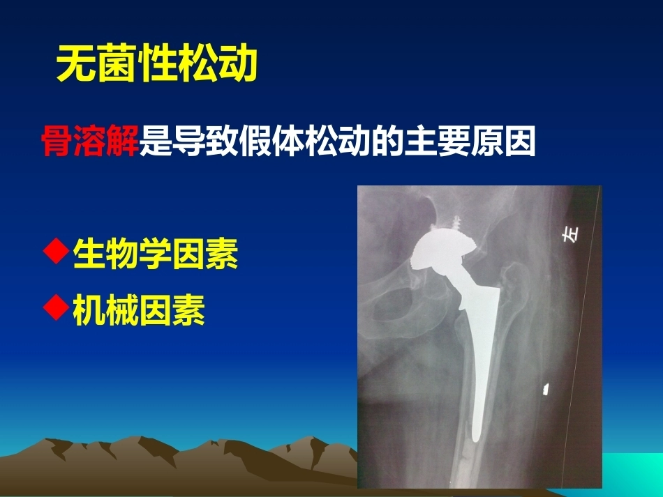 人工全髋关节翻修的思考和 处理策略_第14页