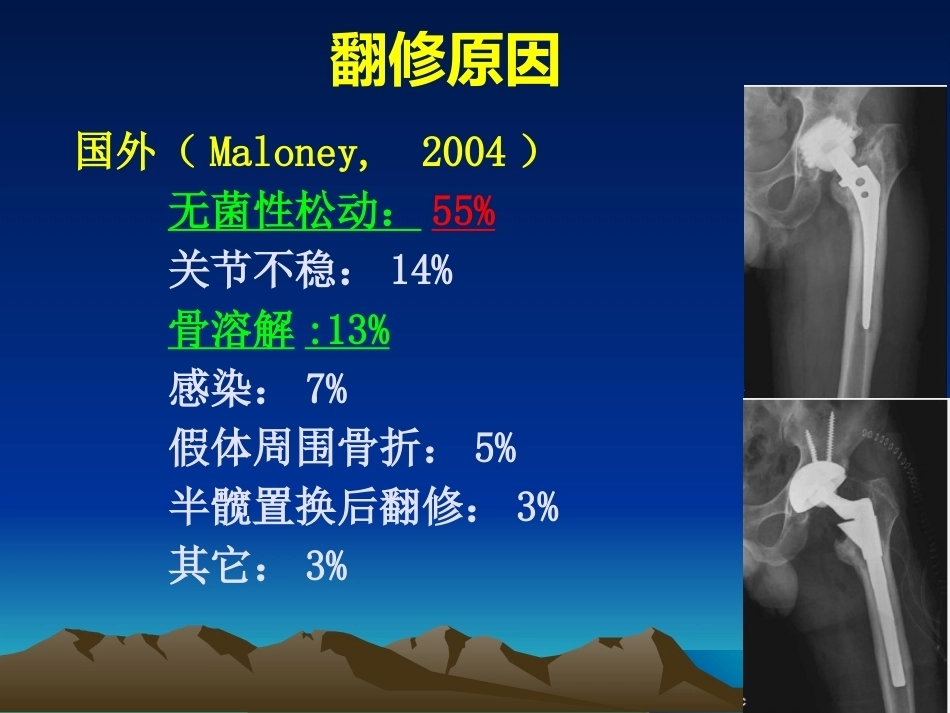 人工全髋关节翻修的思考和 处理策略_第6页