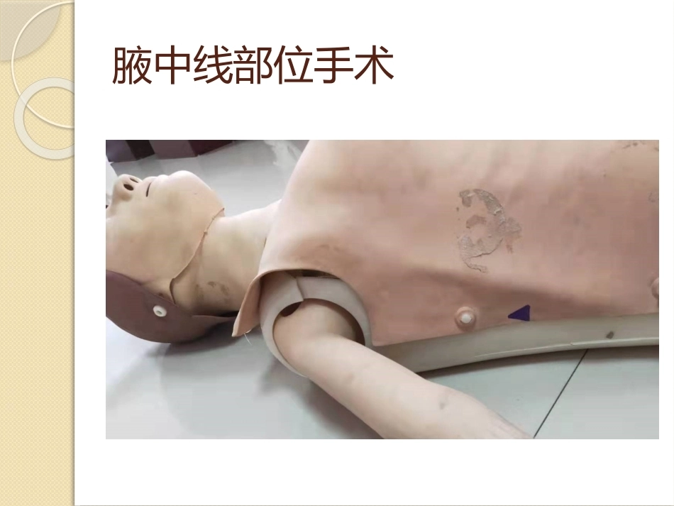 手术 部位标记制度_第15页