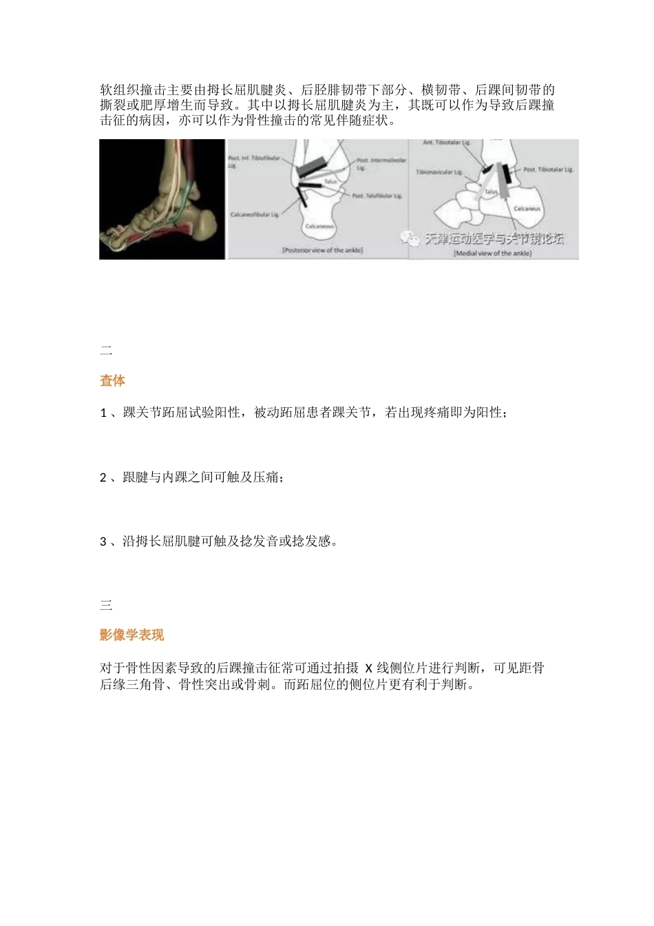 后踝撞击综合征 的诊治技巧_第2页