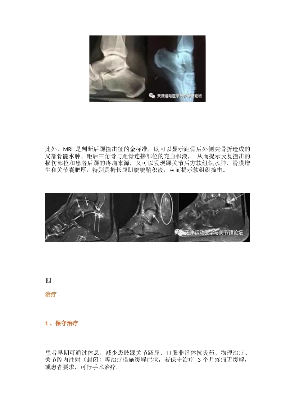 后踝撞击综合征 的诊治技巧_第3页