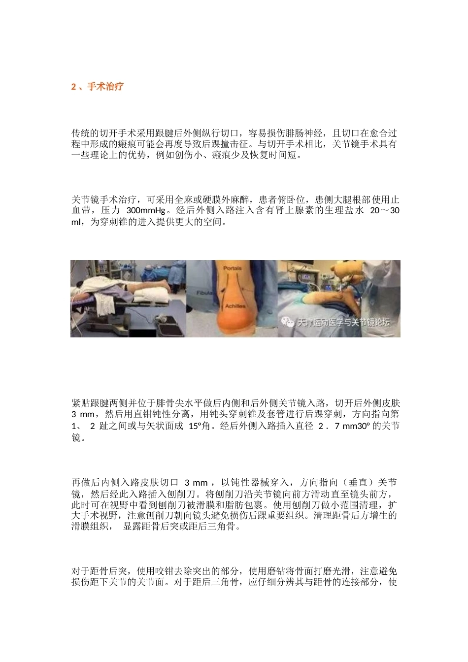 后踝撞击综合征 的诊治技巧_第4页