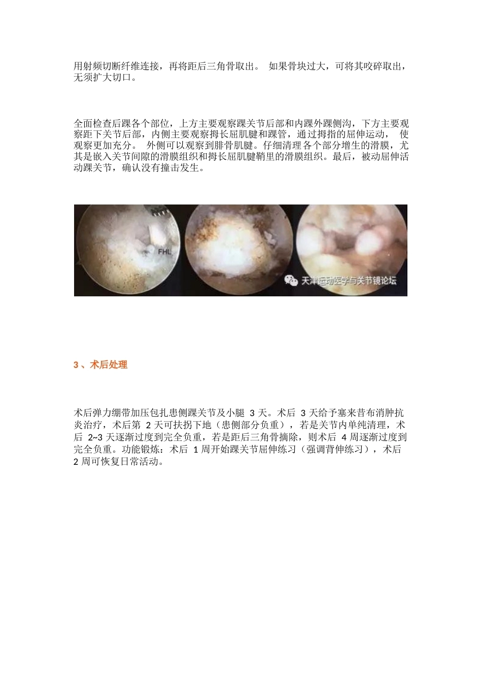 后踝撞击综合征 的诊治技巧_第5页