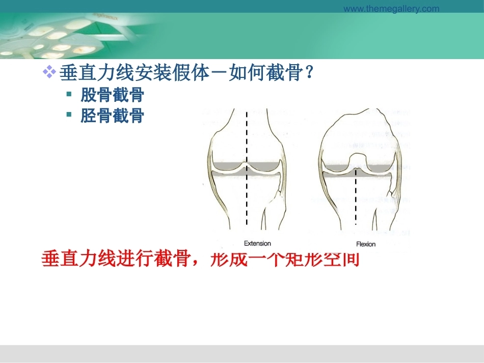 膝关节置换的手 术操作和技巧_第10页