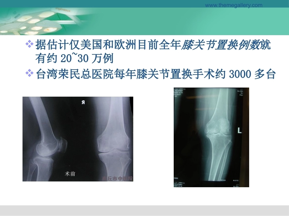 膝关节置换的手 术操作和技巧_第2页