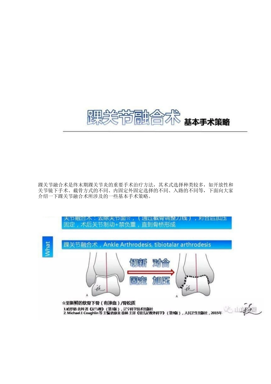 踝关节融合术的基本 手术策略与技巧_第1页