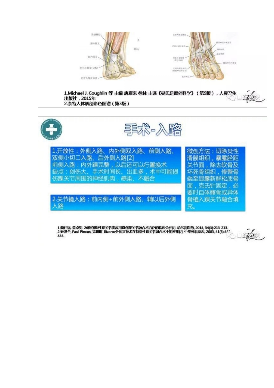 踝关节融合术的基本 手术策略与技巧_第13页