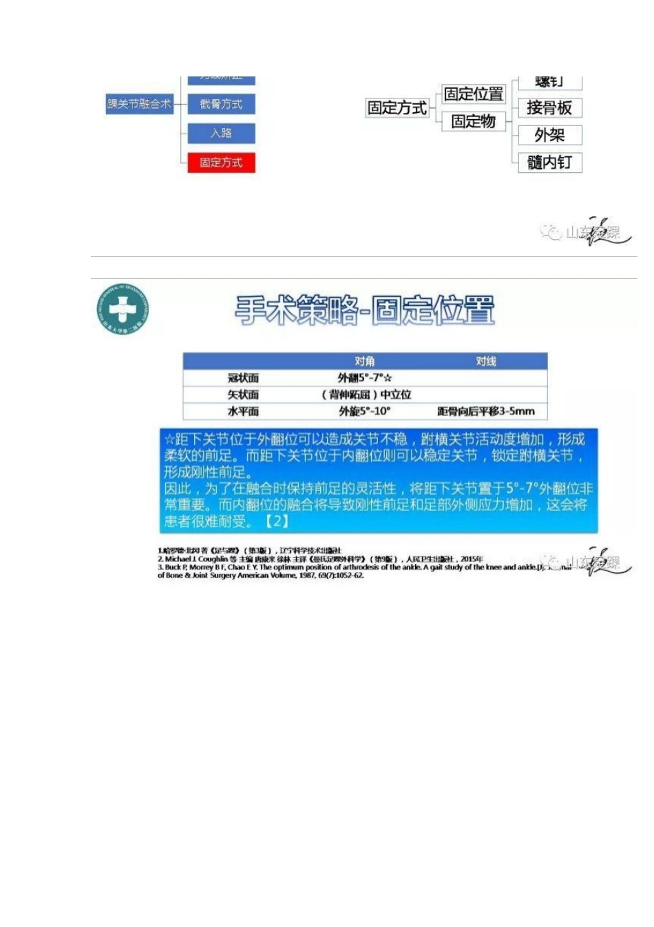 踝关节融合术的基本 手术策略与技巧_第15页