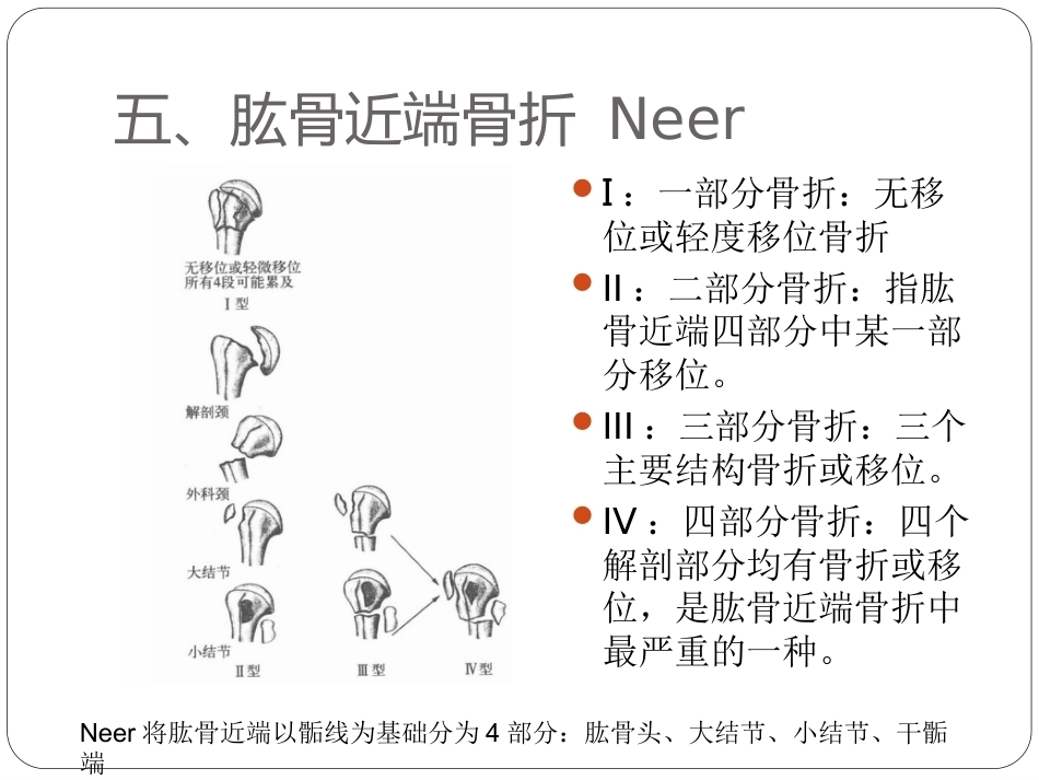 骨与关节骨折分型_第10页