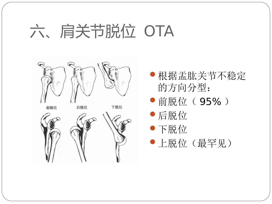 骨与关节骨折分型_第11页