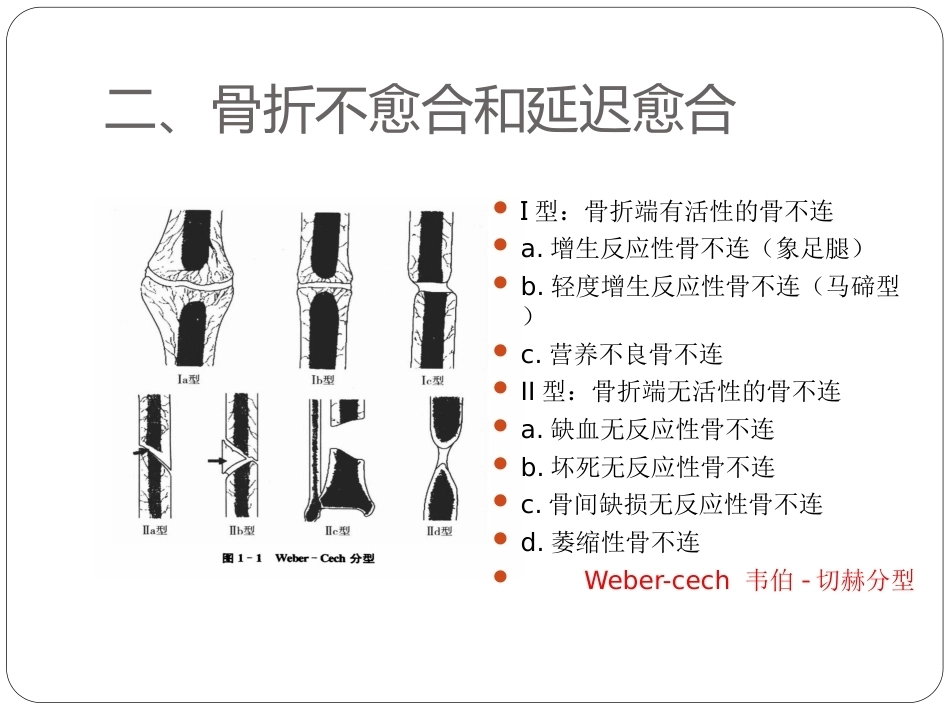 骨与关节骨折分型_第5页