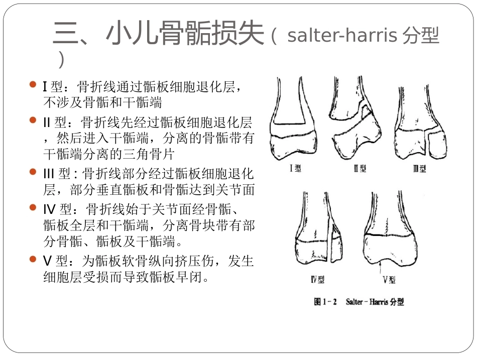 骨与关节骨折分型_第6页