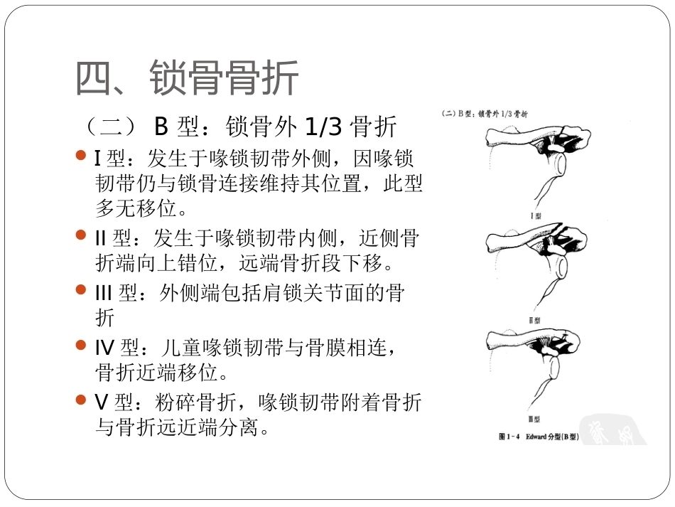 骨与关节骨折分型_第8页