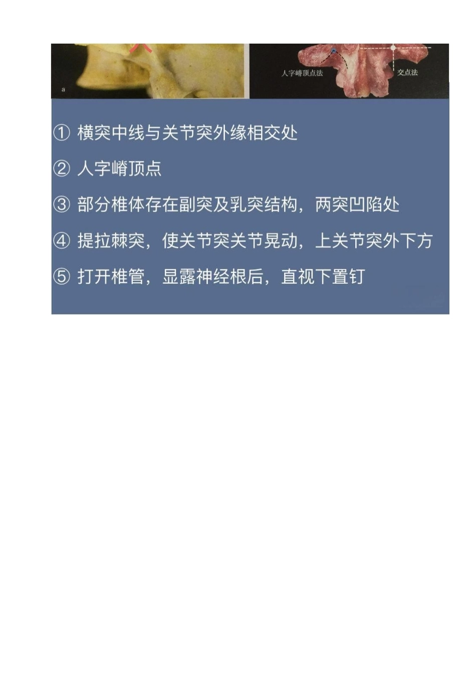 胸椎颈椎腰椎椎弓根置钉技术_第13页