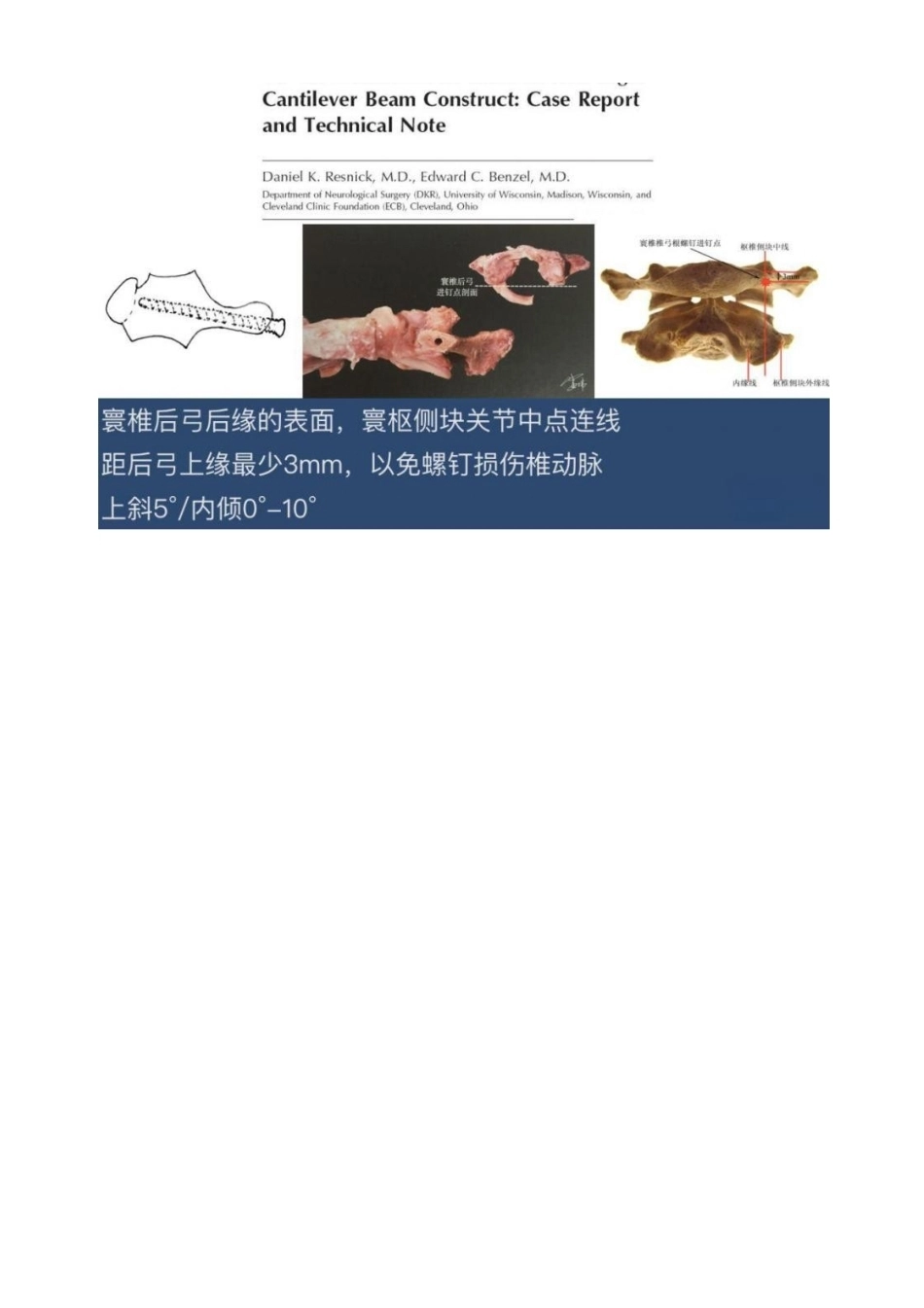 胸椎颈椎腰椎椎弓根置钉技术_第6页