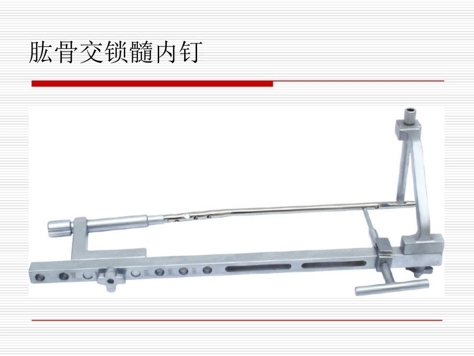 髓内钉应用的基本原则_第10页