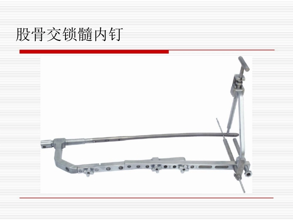 髓内钉应用的基本原则_第13页