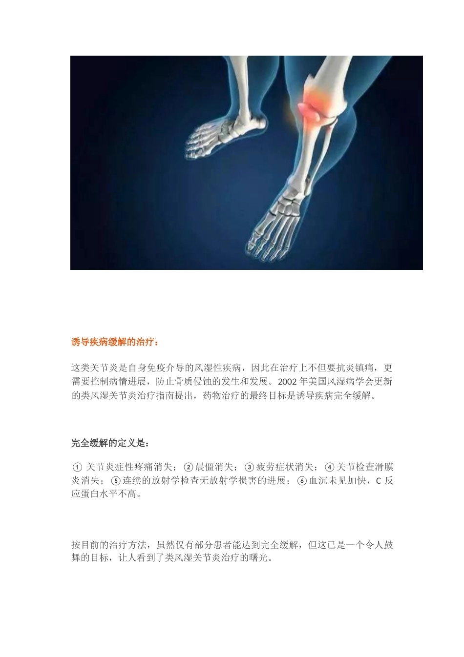 关节炎的分类_第5页