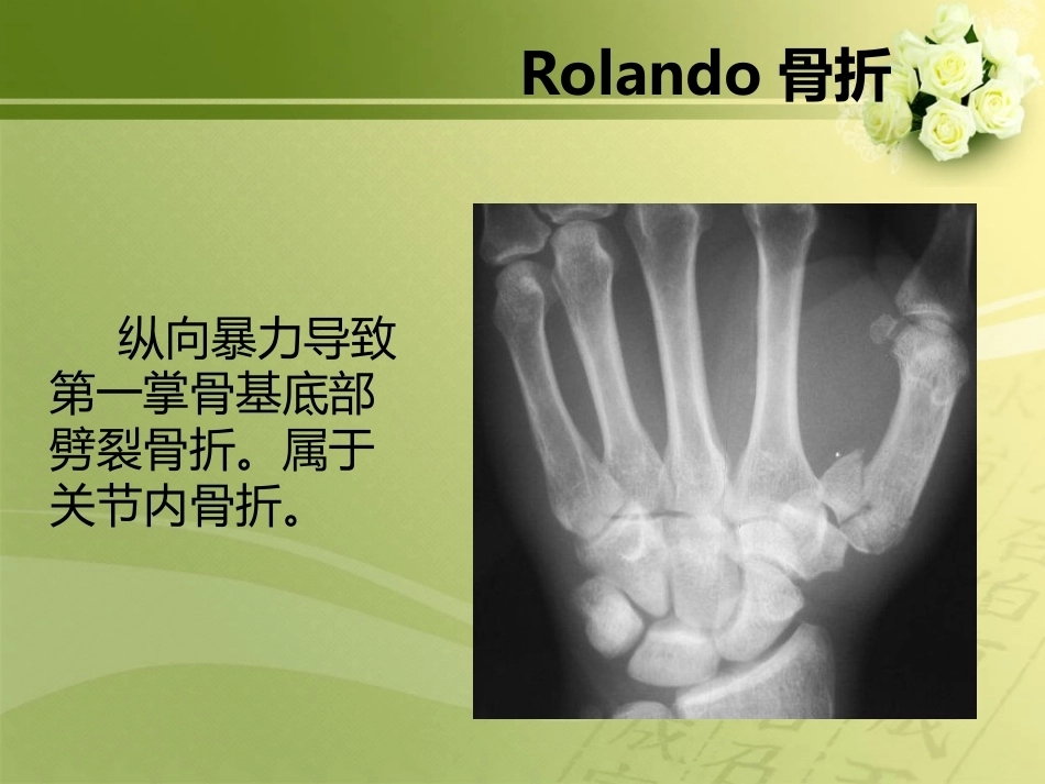 特殊类型骨折_第15页