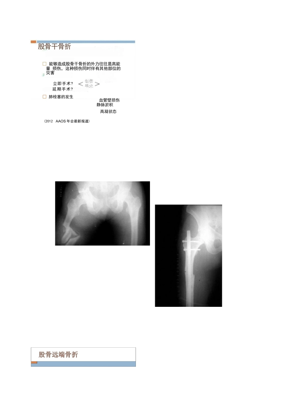 各部位骨折的手术 时机选择_第10页