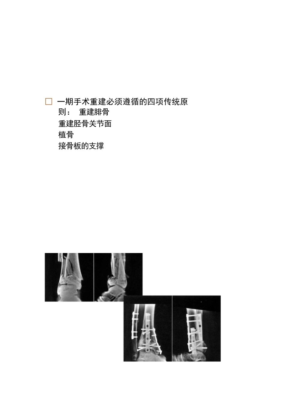 各部位骨折的手术 时机选择_第14页