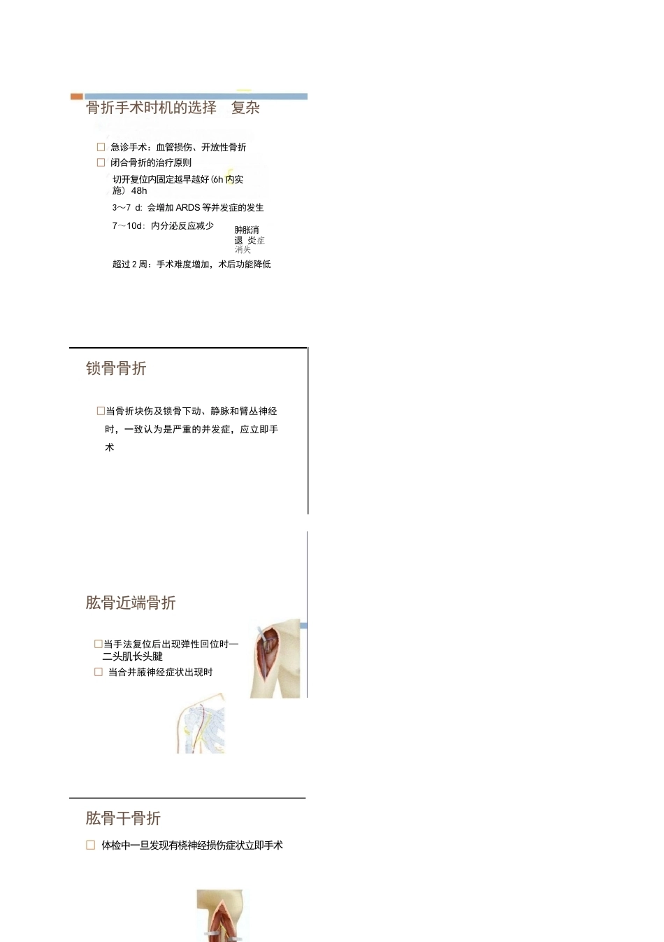 各部位骨折的手术 时机选择_第2页