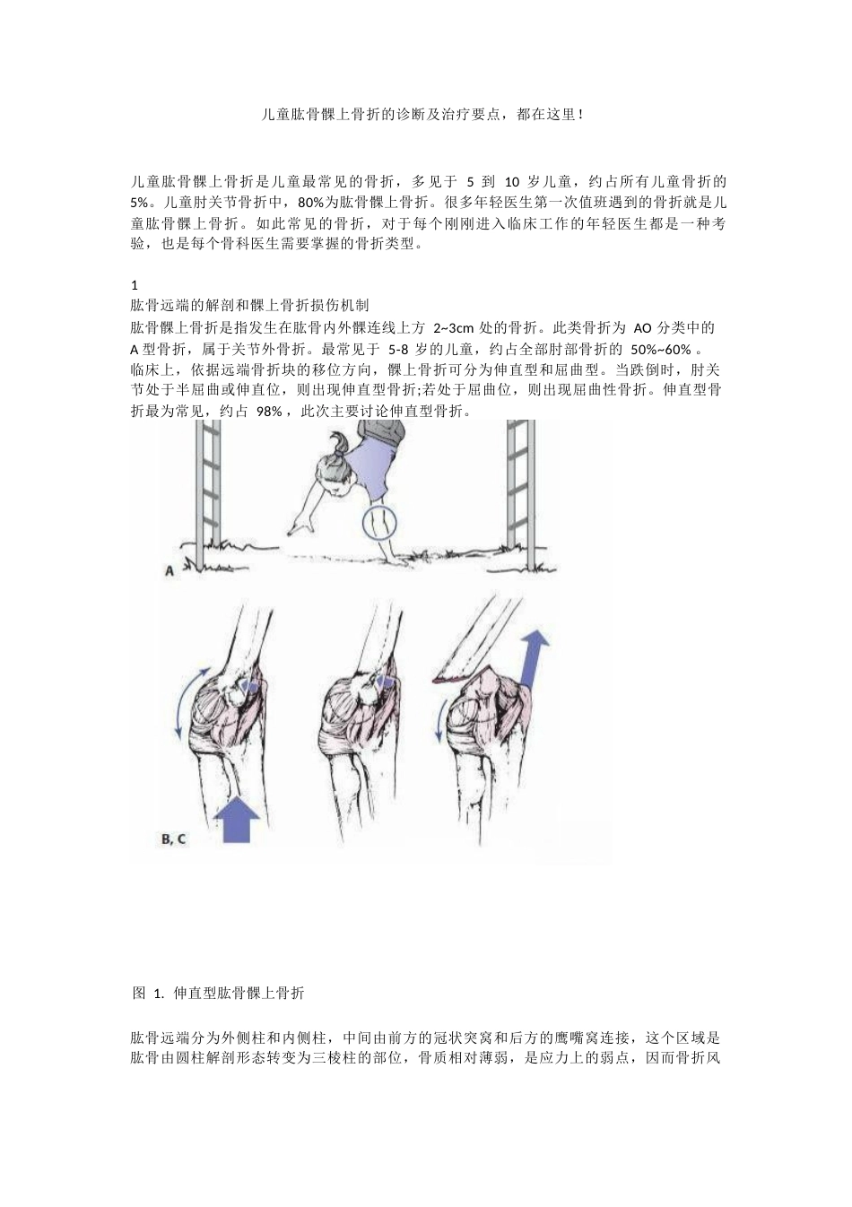 儿童肱骨髁上骨折的诊断 及治疗要点_第1页