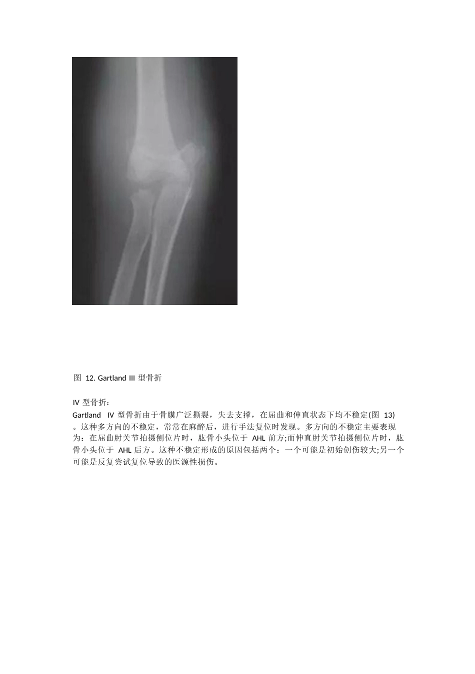 儿童肱骨髁上骨折的诊断 及治疗要点_第10页
