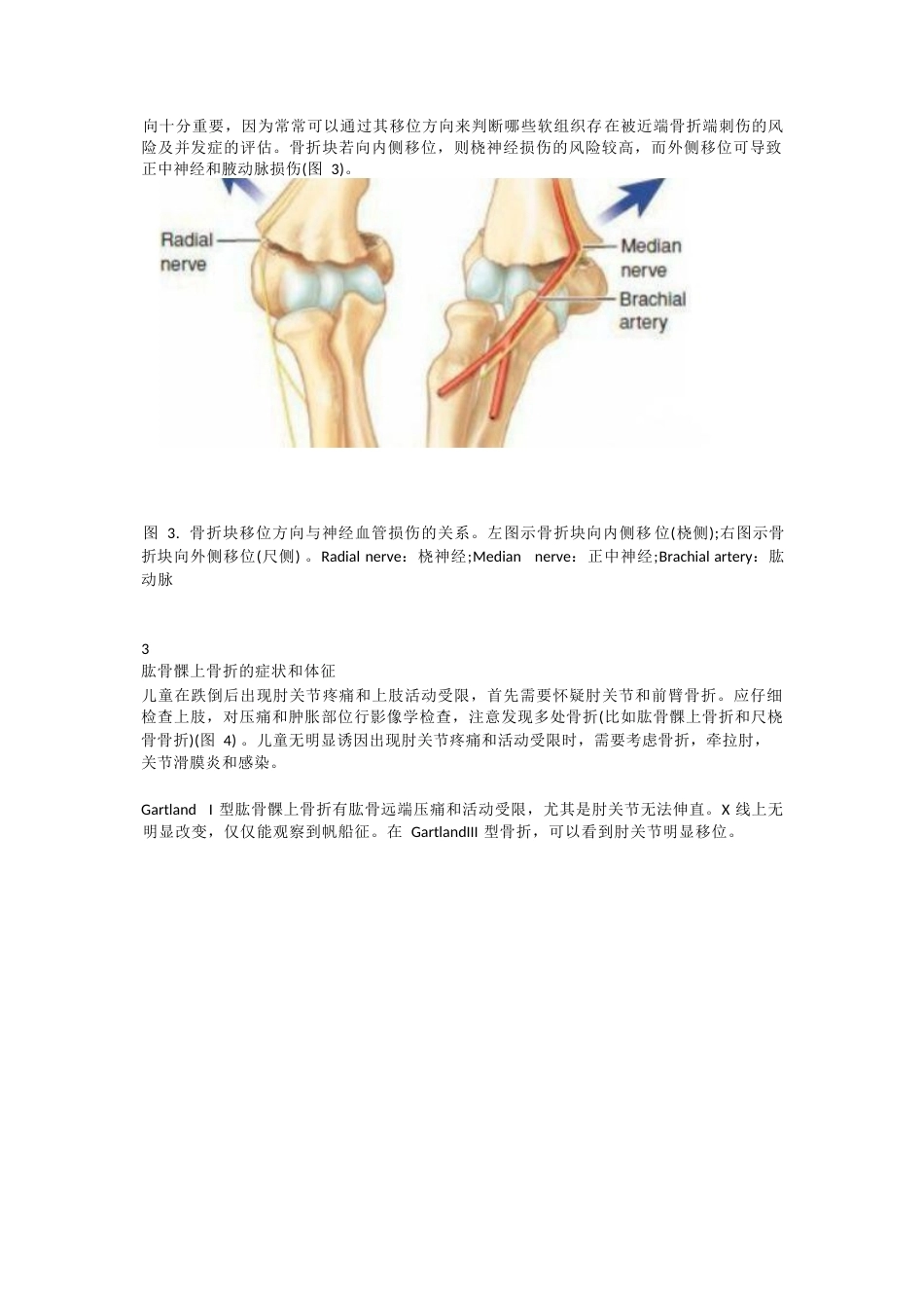 儿童肱骨髁上骨折的诊断 及治疗要点_第3页