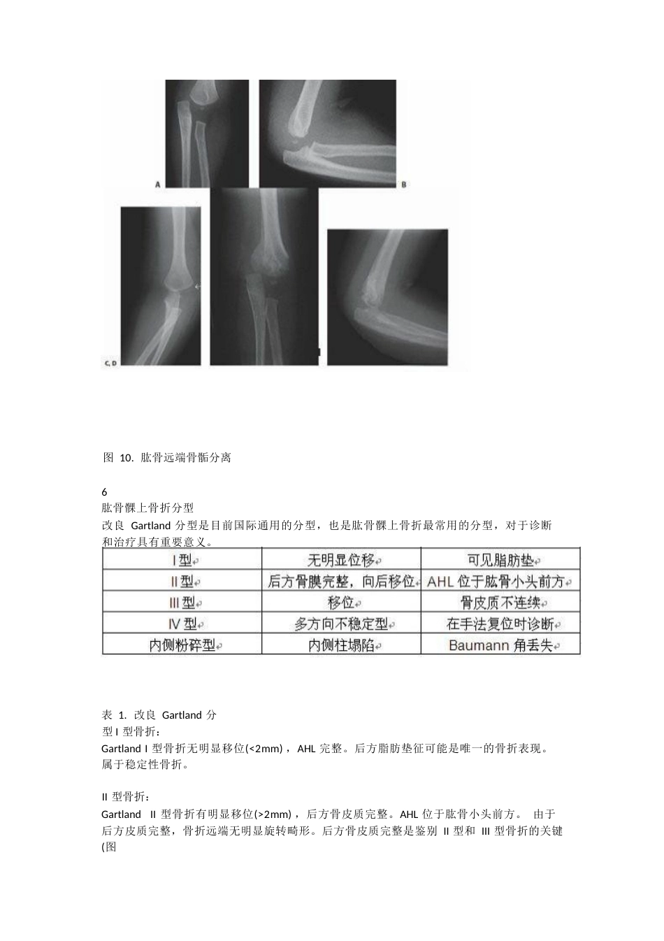 儿童肱骨髁上骨折的诊断 及治疗要点_第8页