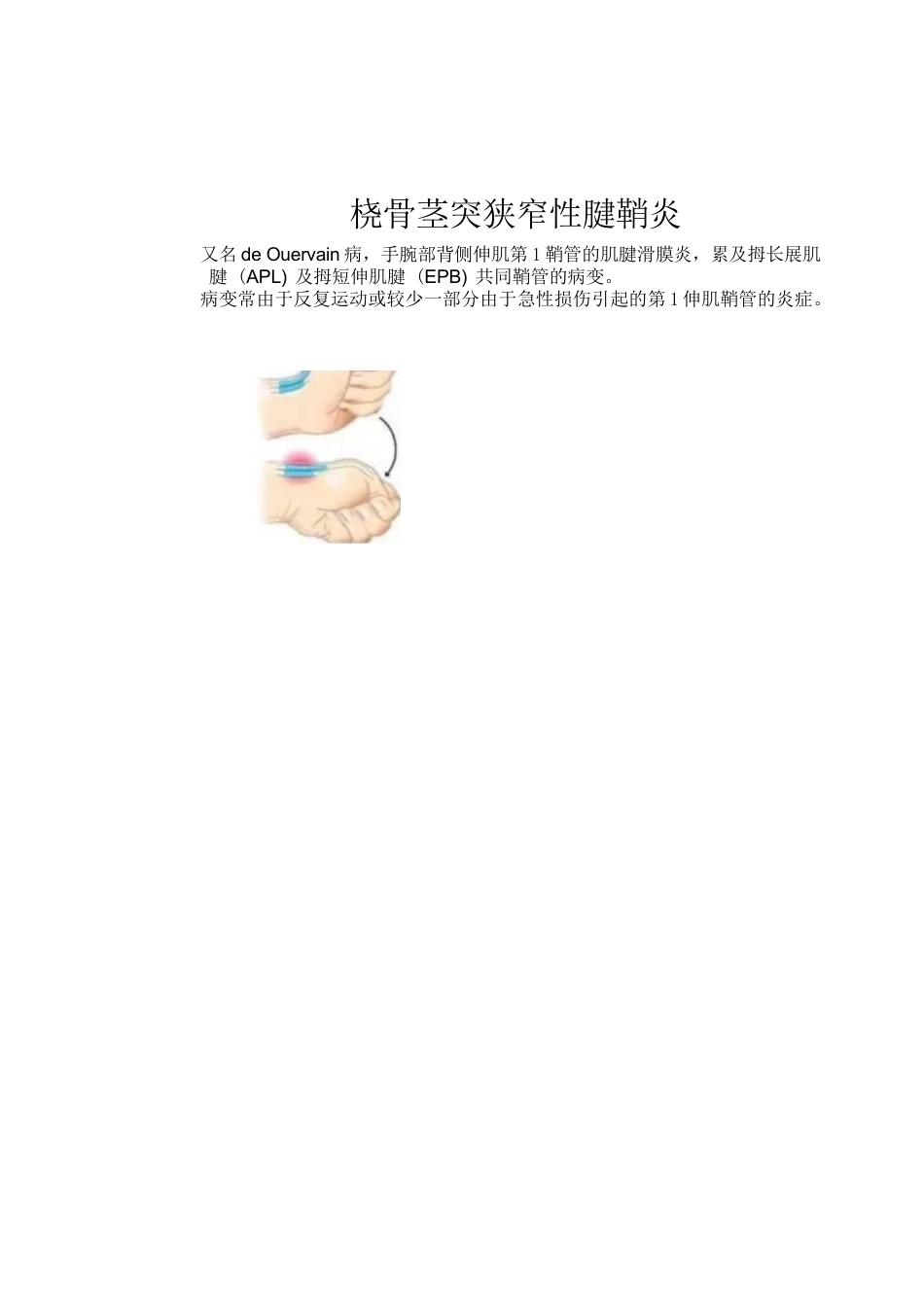 狭窄性 腱鞘炎的诊断及治疗_第3页