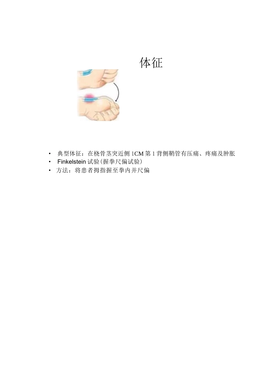 狭窄性 腱鞘炎的诊断及治疗_第4页