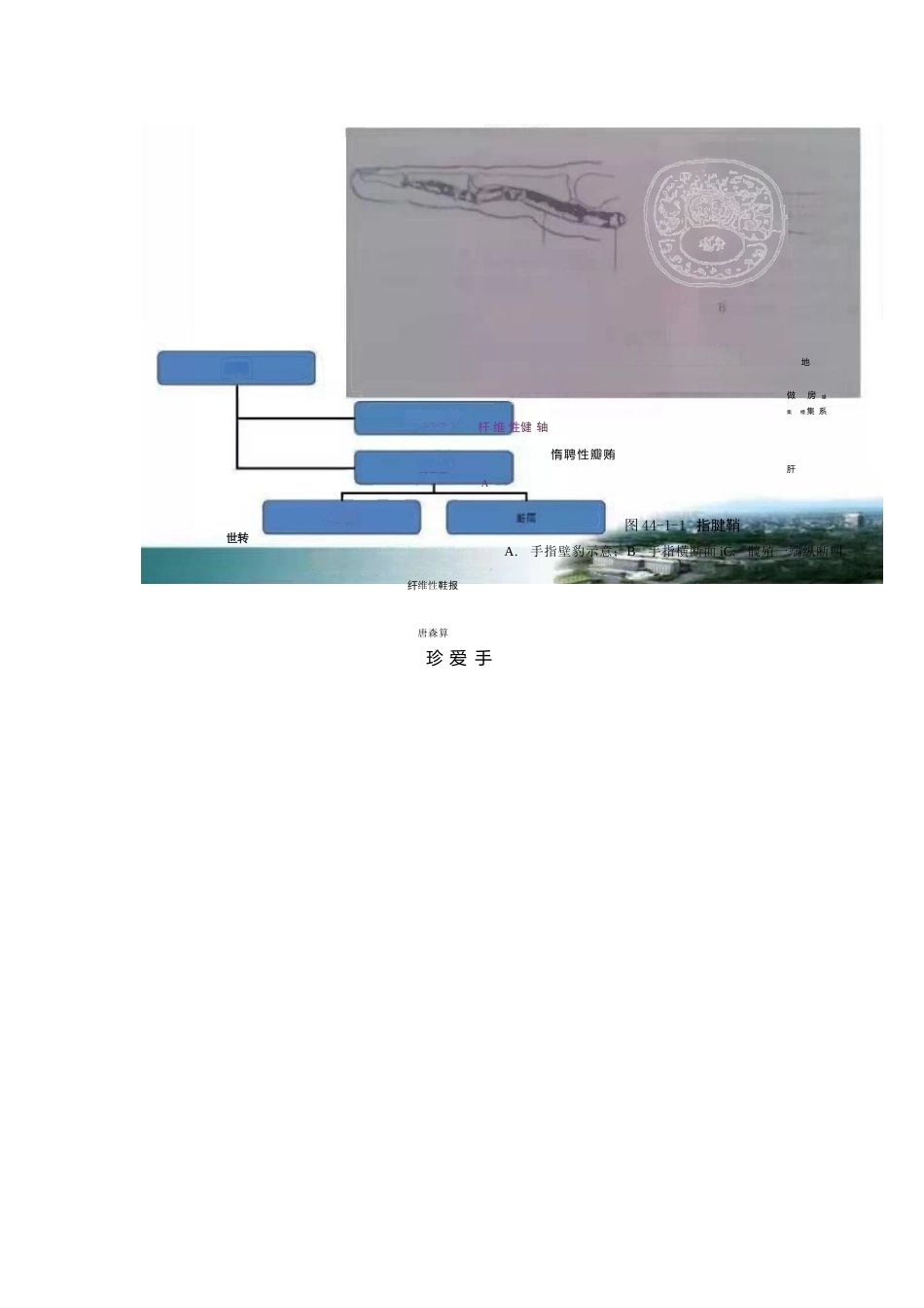 狭窄性 腱鞘炎的诊断及治疗_第6页