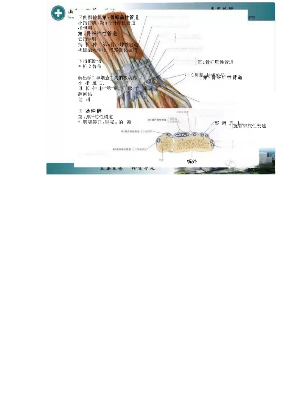 狭窄性 腱鞘炎的诊断及治疗_第7页