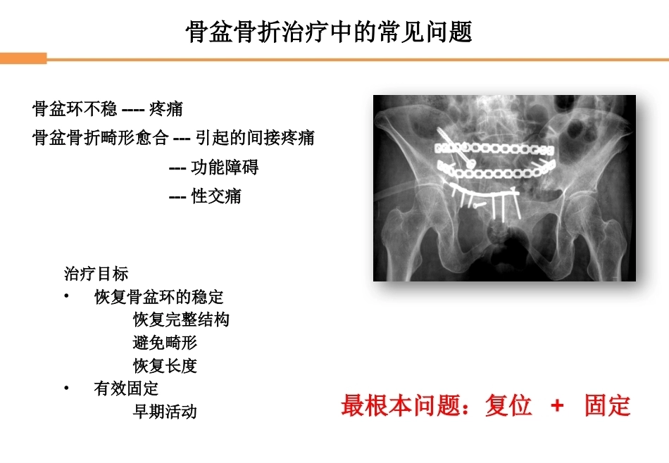骨盆骨折-全_第3页