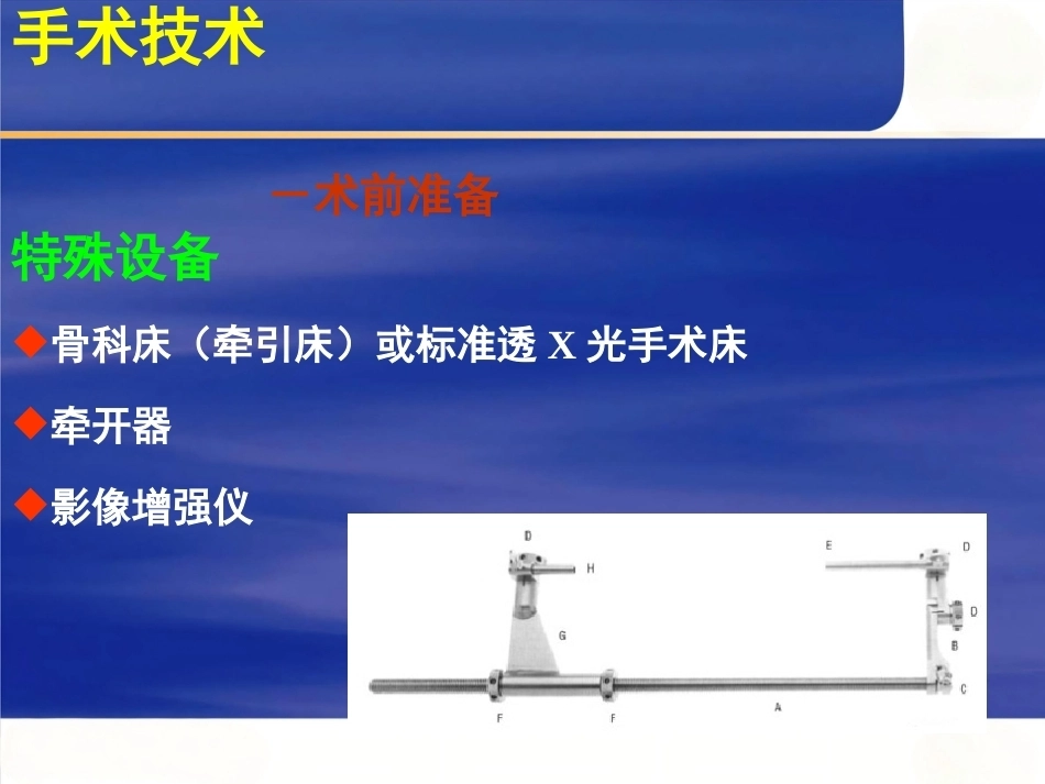 AO髓内钉固定技术_第15页