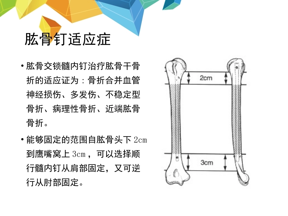 髓内钉应用的基本原则--HYS_第11页