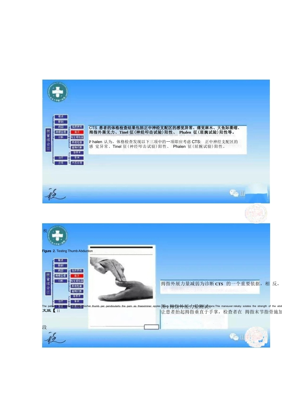 腕管综合征的诊断与治 疗策略_第11页