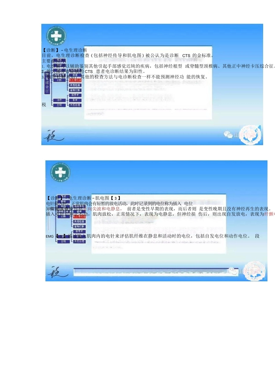 腕管综合征的诊断与治 疗策略_第12页