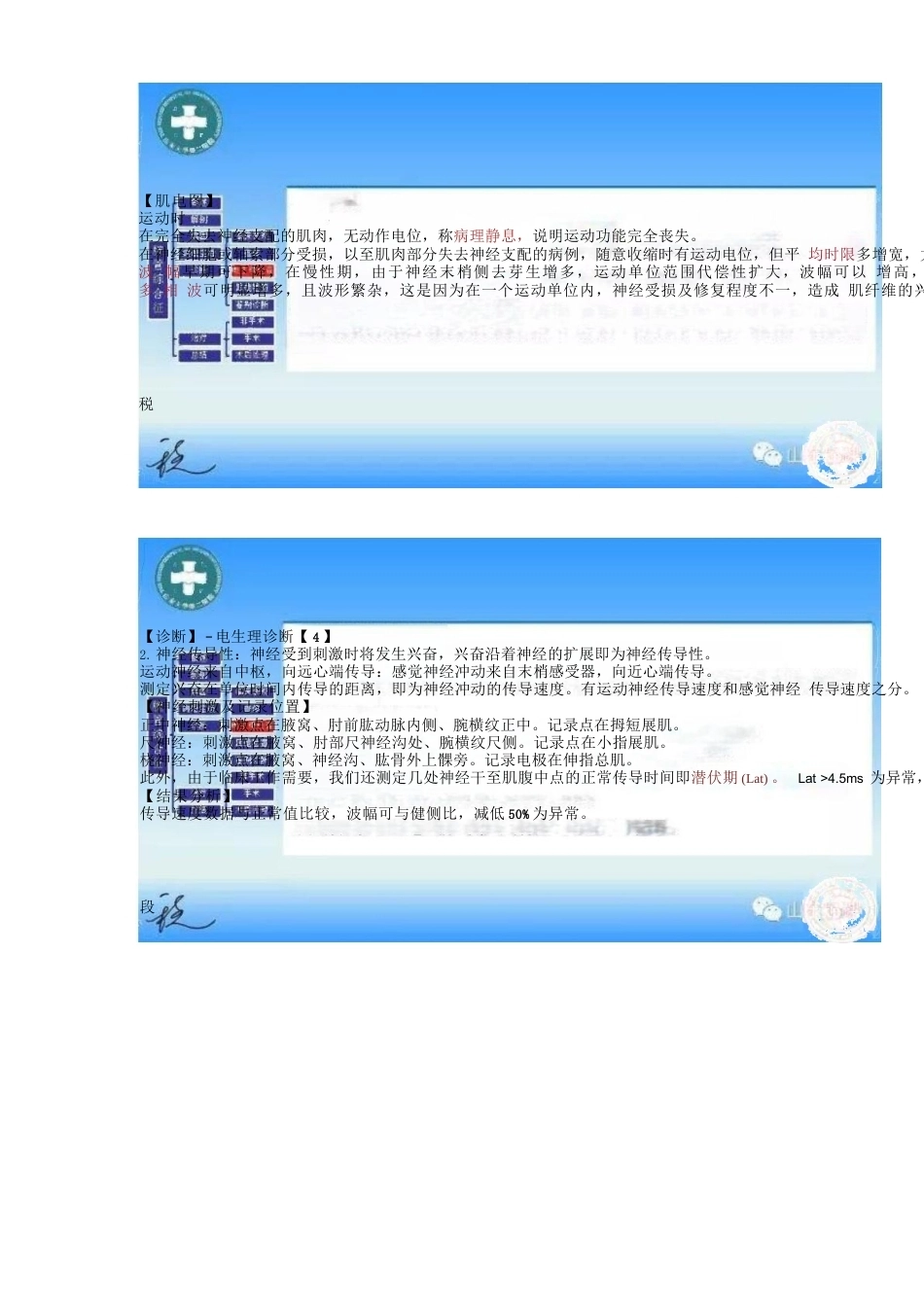 腕管综合征的诊断与治 疗策略_第13页