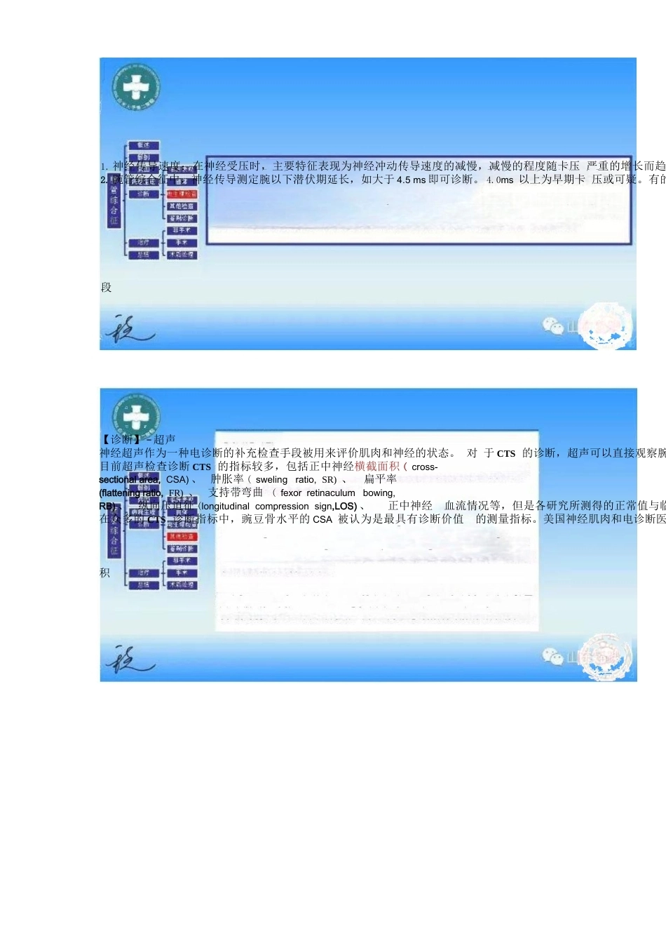 腕管综合征的诊断与治 疗策略_第15页