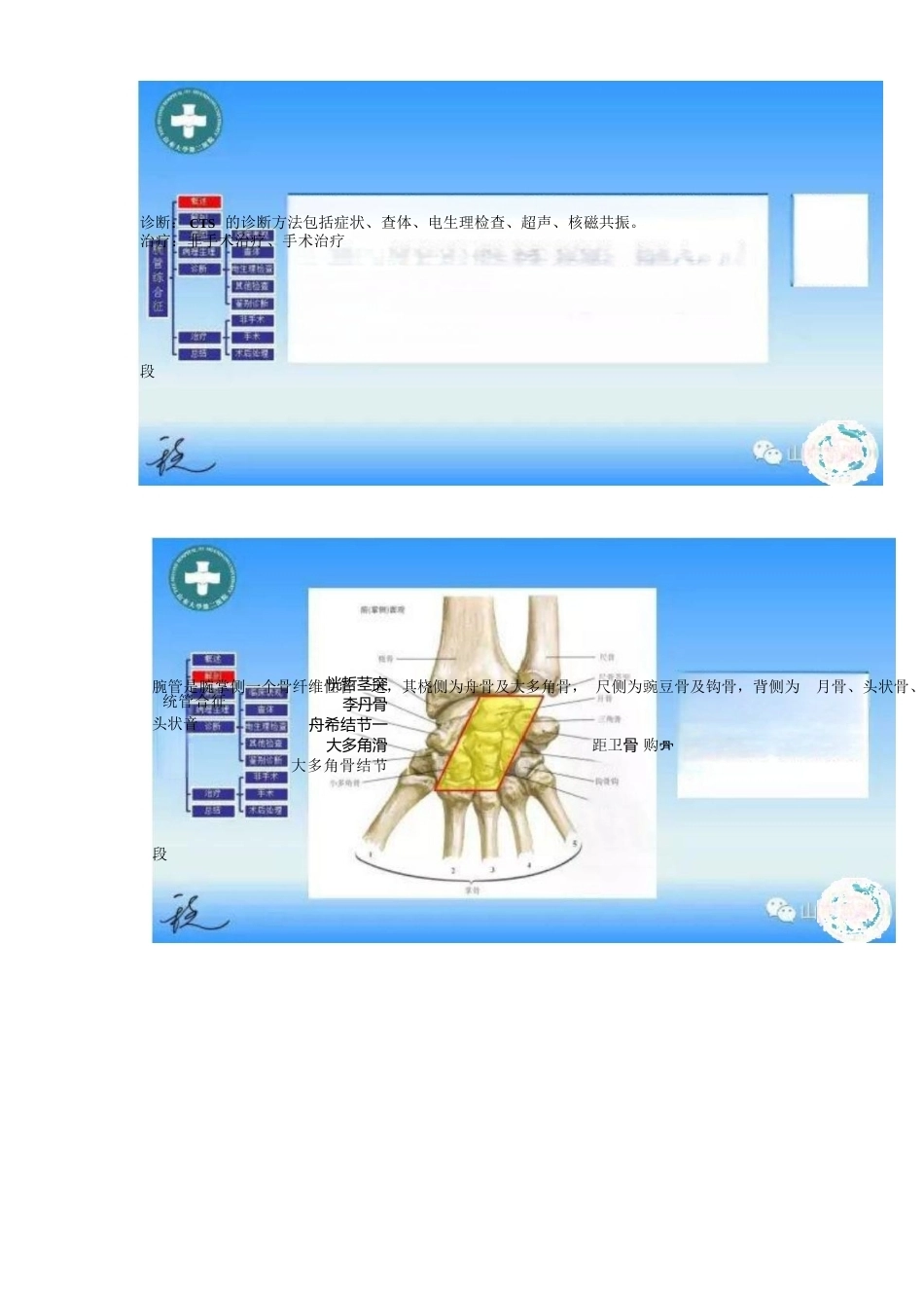 腕管综合征的诊断与治 疗策略_第2页